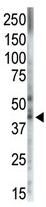 Anti-MAPK11 antibody - Carboxyterminal end (ab37937) at 1/100 dilution + Human placenta lysateObserved band size : 42 kDa (why is the actual band size different from the predicted?)