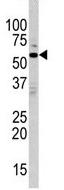 Anti-MAPK15 antibody - N-terminal (ab70911) at 1/60 dilution + T47D cell line lysates at 35 µgObserved band size : 60 kDa (why is the actual band size different from the predicted?)