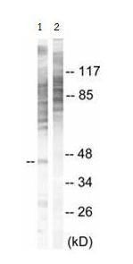All lanes : Anti-MAPKAP Kinase 2 (phospho T334) antibody (ab63378) at 1/500 dilutionLane 1 : NIH/3T3 cell extractLane 2 : NIH/3T3 cell extract with immunising phosphopeptide at 10 µgLysates/proteins at 30 µg per lane.