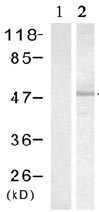 All lanes : Anti-MAPKAP Kinase 2 (phospho T334) antibody (ab131504) at 1/500 dilutionLane 1 : Untreated HeLa cell extractLane 2 : HeLa cell extract treated with UV