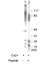 All lanes : Anti-MAPKAP Kinase 2 antibody (ab63574) at 1/500 dilutionLane 1 : HeLa cell extracts treated with Ca2+ (40nM, 30mins)Lane 2 : HeLa cell extracts treated with Ca2+ (40nM, 30mins) with immunising peptide at 10 µgLysates/proteins at 30 µg per lane.