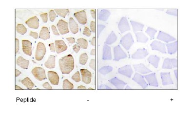 Immunohistochemistry analysis of paraffin-embedded human skeletal muscle tissue using MAPKAP Kinase 3 antibody (ab64972) at 1/50 dilution. Left: no immunising peptide. Right: with immunising peptide.