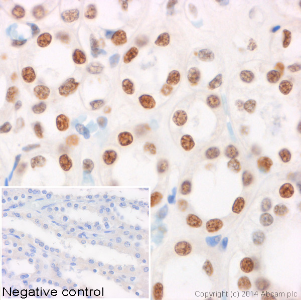 IHC image of ab130740 staining Histone H3 (symmetric di methyl R8) in human kidney formalin fixed paraffin embedded tissue sections, performed on a Leica Bond. The section was pre-treated using heat mediated antigen retrieval with sodium citrate buffer (pH6, epitope retrieval solution 1) for 20 mins. The section was then incubated with ab130740, 5µg/ml, for 15 mins at room temperature and detected using an HRP conjugated compact polymer system. DAB was used as the chromogen. The section was then counterstained with haematoxylin and mounted with DPX. No primary antibody was used in the negative control (shown on the inset).For other IHC staining systems (automated and non-automated) customers should optimize variable parameters such as antigen retrieval conditions, primary antibody concentration and antibody incubation times.