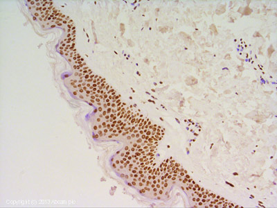 IHC image of Histone H3 (symmetric di methyl R8) staining in Human Skin formalin fixed paraffin embedded tissue section, performed on a Leica Bond system using the standard protocol F. The section was pre-treated using heat mediated antigen retrieval with sodium citrate buffer (pH6, epitope retrieval solution 1) for 20 mins. The section was then incubated with ab130740, 1µg/ml, for 15 mins at room temperature and detected using an HRP conjugated compact polymer system. DAB was used as the chromogen. The section was then counterstained with haematoxylin and mounted with DPX.