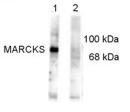 All lanes : Anti-MARCKS (phospho S152 + S156) antibody (ab32590) at 1/1000 dilutionLane 1 : Rat brain lysateLane 2 : Rat brain lysate with Ser152/156 phosphopeptide used as antigenLysates/proteins at 10 µg per lane.