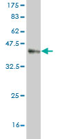 Western blot against tagged recombinant protein immunogen using ab57596 MARCKS like protein antibody at 1ug/ml.