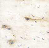 ab60202, at 1/50 dilution, staining MARK1 in formalin fixed, paraffin-embedded human brain tissue by immunohistochemistry. ab60202 was peroxidase-conjugated to the secondary antibody, followed by DAB staining.