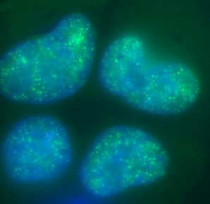 Immunofluorescent imaging of human cells (U2OS) with ab6002 reveals broadly dispersed interphase nuclear staining corresponding to trimethylation of K27, with multiple foci of brighter staining, exactly agreeing with published studies of K27-trimethyl IF [See figure 3 of Peters et al Mol Cell 12(6):1577-1589 (2003)] .  The lack of nucleolar or cytoplasmic staining background confirms the high specificity of the antibody in this application.    IF was performed with a standard paraformaldehyde technique (fixed in PBS buffered PFH 4% for 5 minutes, permeabilised with 0.5% triton-PBS for 5 minutes, blocked with 5% milk / 0.2% tween for one hour.  Primary antibody used at 1/200 in 5% milk / 0.2% TWEEN for one hour, secondary antibody Alexa 488 for 30 minutes.  All blocking and incubation steps carried out at 37 degrees C.  