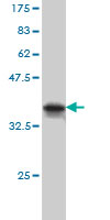 Western blot against tagged recombinant protein immunogen using ab54997 MARK2 antibody at 1ug/ml.