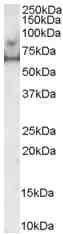 Anti-MARK4 antibody (ab5262) at 0.5 µg + Human Prostate lysate (35µg protein in RIPA buffer).