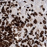 ab130426, at a dilution of 1/200, staining MARS2 in paraffin-embedded Human stomach tissue by Immunohistochemistry.