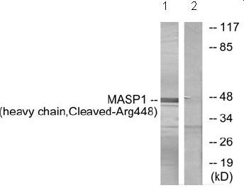 All lanes : Anti-MASP1 antibody (ab72659) at 1/500 dilutionLane 1 : Extracts from A549 cells, treated with etoposide (25uM, 24hours)Lane 2 : Extracts from A549 cells, treated with etoposide (25uM, 24hours) with Cl-peptide at 10 µgLysates/proteins at 30 µg per lane.