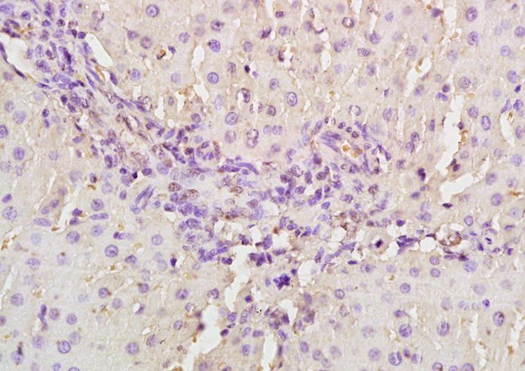 Immunohistochemical amalysis of formalin-fixed and paraffin embedded rat liver tissue labeling MASP2 using ab203241 at 1/200 dilution, followed by conjugation to the secondary antibody and DAB staining.