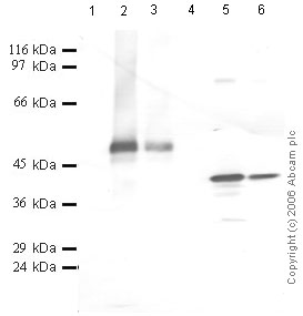 All lanes : Anti-MASPIN antibody (ab42352) at 1/1000 dilutionLane 1 : Negative controlLane 2 : Yeast recombinant Maspin at 0.05 µgLane 3 : Yeast recombinant Maspin at 0.01 µgLane 4 : Negative controlLane 5 : Bacterial recombinant Maspin at 0.05 µgLane 6 : Bacterial recombinant Maspin at 0.01 µg