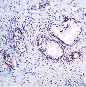 Cytoplasmic staining of glandular basal cells in formalin-fixed, paraffin-embedded human prostate tissue, using ab75450 in conjunction with a peroxidase-conjugated secondary antibody and an AEC chromogen.