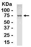 Anti-MAT2A antibody (ab26174) at 1/2000 dilution + 0.5ug E coli derived fusion protein SecondaryGoat anti IgY HRP at 1/1000 dilution