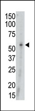 Anti-MATK antibody (ab37824) at 1/100 dilution + Mouse thymus tissue lysate