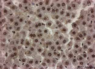 ab9050 staining rat liver tissue sections by IHC-P.  The section was formaldehyde fixed and subjected to heat mediated antigen retrieval in pH 6.0 citrate buffer prior to being blocked with 5% serum for 30 minutes at 45°C.  The primary antibody was diluted 1/500 and incubated for 45 minutes at 20°C.  A HRP conjugated goat anti-rabbit was used as the secondarySee Abreview