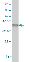 Western blot against tagged recombinant protein immunogen using ab55458 Matrilin 2 antibody at 1ug/ml.