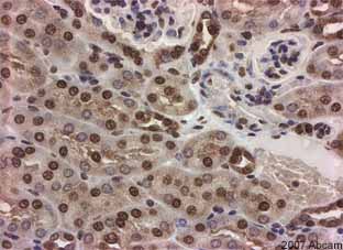 ab9050 staining mouse kidney tissue sections by IHC-P.  The section was formaldehyde fixed and subjected to heat mediated antigen retrieval in pH 6.0 citrate buffer prior to being blocked with 5% serum for 30 minutes at 20°C.  The primary antibody was diluted 1/500 and incubated for 45 minutes at 20°C.  A HRP conjugated goat anti-rabbit was used as the secondarySee Abreview