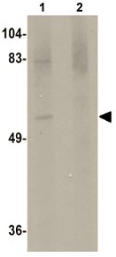 All lanes : Anti-Matrilin 4 antibody (ab106379) at 1 µg/mlLane 1 : Rat brain tissue lysateLane 2 : Rat brain tissue lysate with blocking peptideLysates/proteins at 15 µg per lane.