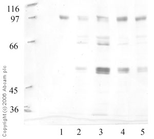 All lanes : Anti-Matriptase 2 antibody - Catalytic domain (ab59783) at 1/1000 dilutionLane 1 : SK-HEP-1 CM sfLane 2 : SK-HEP-1 TPALane 3 : SK-HEP-1 IL-1bLane 4 : SK-HEP-1 TNFaLane 5 : SK-HEP-1 RA