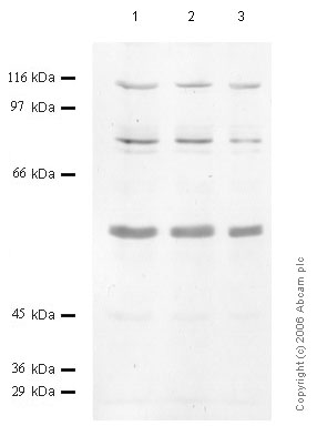 All lanes : Anti-Matriptase 2 antibody - CUB-2 domain (ab56181) at 1/1000 dilutionLane 1 : Cell media from human embryonic kidney HEK293 cellsLane 2 : Cell media from human embryonic kidney HEK293 cellsLane 3 : Cell media from human embryonic kidney HEK293 cells