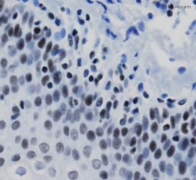 ab38646 staining MBD2 in Human tonsil tissue sections by Immunohistochemistry (IHC-P - paraformaldehyde-fixed, paraffin-embedded sections). Tissue was fixed with paraformaldehyde and blocked with 1% BSA for 10 minutes at 25°C; antigen retrieval was by heat mediation in a citrate buffer, pH 6.0. Samples were incubated with primary antibody (1/500 in TBS) for 12 hours at 4°C. An undiluted alkaline phosphatase-conjugated Goat anti-rabbit IgG polyclonal was used as the secondary antibody.See Abreview