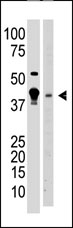 All lanes : Anti-MBD2 antibody (ab38646)Lane 1 : A375 cell lysate Lane 2 : mouse brain tissue lysate