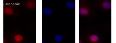 ab38646 staining MBD2 in rat liver cultured cells by Immunocytochemistry/ Immunofluorescence. The cells were fixed in formaldehyde, permeabilised in 0.1% Triton X-100 and then blocked using 1% BSA for 1 hour at 25°C. Samples were then incubated with primary antibody at 1/50 for 10 hours at 25°C. The secondary antibody used was a goat anti-rabbit IgG conjugated to Alexa Fluor® 568 (red) used at a 1/400 dilution.