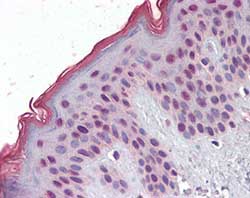 ab105323, at 2.5 µg/ml, staining MBD2 in formalin-fixed, paraffin-embedded Human Skin tissue by Immunohistochemistry, using a biotinylated anti-goat IgG secondary antibody, alkaline phosphatase-streptavidin and chromogen.