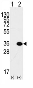 All lanes : Anti-MBD3 antibody - Carboxyterminal end (ab71777) at 1/100 dilutionLane 1 : Non-transfected 293 cell lysatesLane 2 : MBD3 transfected 293 cell lysatesLysates/proteins at 2 µg per lane.