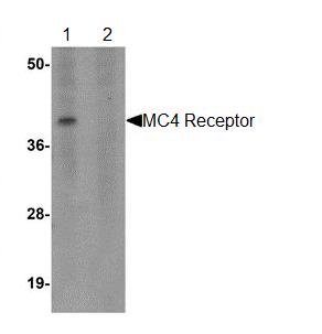 All lanes : Anti-MC4 Receptor antibody (ab106596) at 1 µg/mlLane 1 : Rat brain tissue lysate Lane 2 : Rat brain tissue lysate with blocking peptideLysates/proteins at 15 µg per lane.