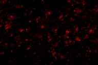 Immunofluorescence of MC4R in Human Brain cells using ab106596 at 20 ug/ml.