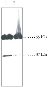 All lanes : Anti-MC4 Receptor antibody (ab24233)Lane 1 : Human cerebella cortex pellet.Lane 2 : Human hippocampus homogenate.Lysates/proteins at 30 µg per lane.