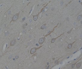 Immunoperoxidase staining of rat brain section with ab24233. Note the tadpole like staining of cortex neurons.