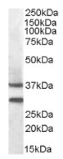 Anti-MC5 Receptor antibody (ab92287) at 0.3 µg/ml + Mouse Muscle lysate at 35 µg