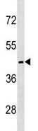 Anti-MC5 Receptor antibody - C-terminal (ab139151) at 1/100 dilution + HL60 cell line lysates at 35 µgdeveloped using the ECL technique