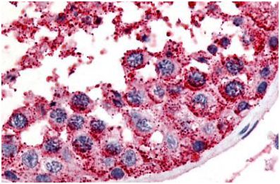 Immunohistochemical analysis of formalin-fixed, paraffin-embedded Human testis tissue (spermatogenic series) labelling MC5 Receptor with ab140852 at 7.6 µg/ml.