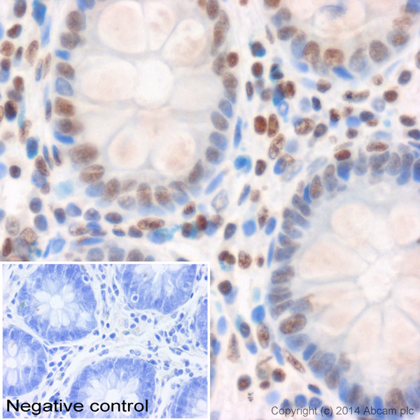 IHC image of ab8580 staining Histone H3 (tri methyl K4) in normal human colon formalin-fixed paraffin-embedded tissue sections*, performed on a Leica Bond. The section was pre-treated using heat mediated antigen retrieval with sodium citrate buffer (pH6, epitope retrieval solution 1) for 20 mins. The section was then incubated with ab8580, 1/500 dilution, for 15 mins at room temperature and detected using an HRP conjugated compact polymer system. DAB was used as the chromogen. The section was then counterstained with haematoxylin and mounted with DPX. No primary antibody was used in the negative control (shown on the inset).For other IHC staining systems (automated and non-automated) customers should optimize variable parameters such as antigen retrieval conditions, primary antibody concentration and antibody incubation times.*Tissue obtained from the Human Research Tissue Bank, supported by the NIHR Cambridge Biomedical Research Centre