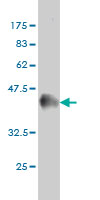 Western blot against tagged recombinant protein immunogen using ab55489 MCC antibody at 1ug/ml.