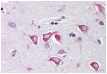 Immunohistochemical analysis of paraffin-embedded, formalin-fixed Human brain, cortex, tissue labeling MCG10 using ab190211 at 2.5 µg/ml.