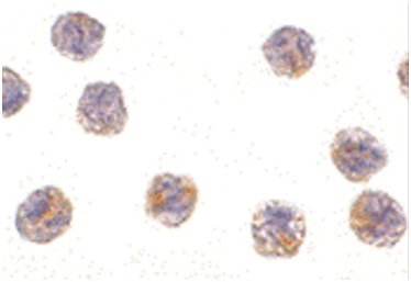 Immunocytochemical analysis of HeLa cells labeling MCG10 using ab190211 at 1 µg/ml.