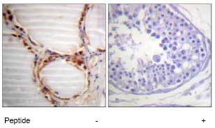 ab74237 at 1/50 dilution staining MCM4 in human testis by Immunohistochemistry using Paraffin-embedded tissue, in the absence or presence of the immunising peptide.
