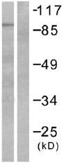 All lanes : Anti-MCM5 antibody (ab53140) at 1/500 dilutionLane 1 : HepG2 cell lysate minus immunising peptideLane 2 : HepG2 cell lysate plus immunising peptide