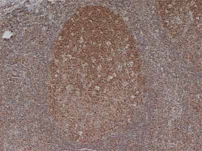 ab6154 staining MCM5 in human tonsil by Immunohistochemistry (Formalin/PFA-fixed paraffin-embedded sections).