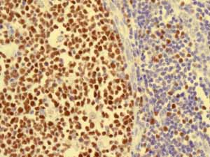 ab76023 showing positive staining in Normal tonsil tissue.