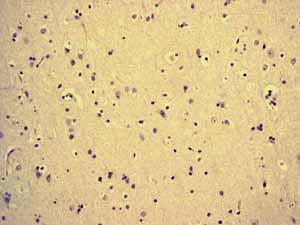 ab76023 showing negative staining in Normal brain tissue.