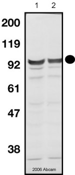 All lanes : Anti-MCM7 antibody [47DC141] (ab2360) at 1/200 dilutionLane 1 : M phase Xenopus laevis egg extract, whole tissue lysate.Lane 2 : I phase Xenopus laevis egg extract, whole tissue lysate.SecondaryHRP conjugated Donkey anti-rabbit IgGdeveloped using the ECL technique