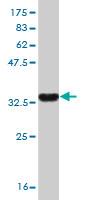 Western blot against tagged recombinant protein immunogen using ab57829 MCM8 antibody at 1ug/ml.